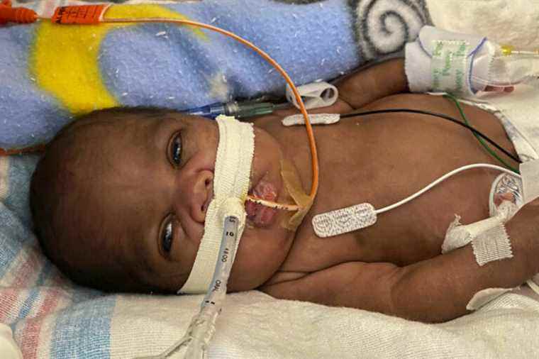 Alabama boy certified as world’s most premature baby