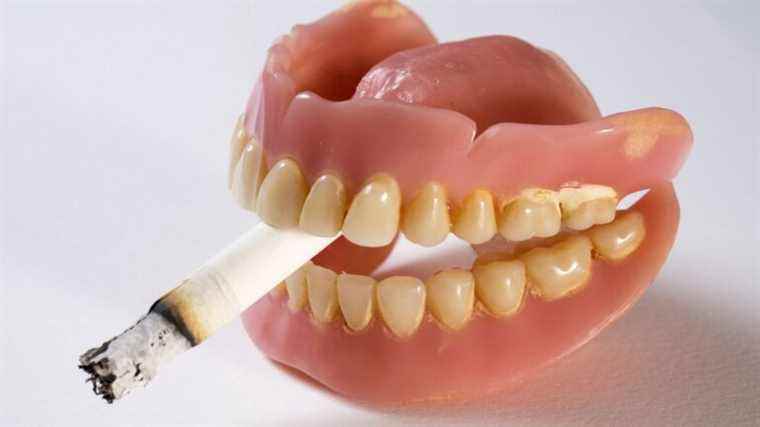 One more motivation to quit smoking: save your teeth!