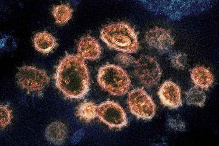 The toll of COVID-19 compared to other deadly viruses