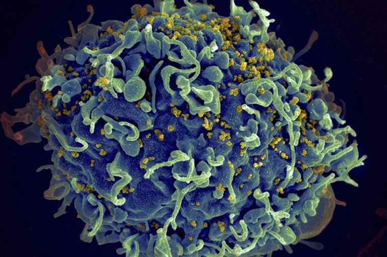 HIV mRNA vaccine |  “Promising” but imperfect results