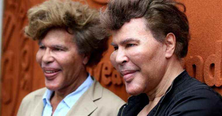 Igor and Grichka Bogdanoff, the truth about their deformed chin: “It’s not a disease, it’s …”