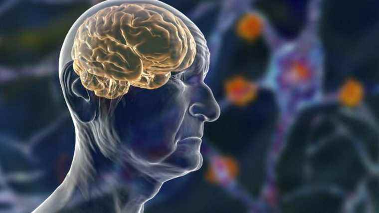 Researchers identify the virus that causes multiple sclerosis