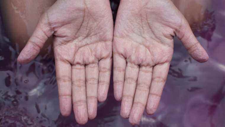 Why do you have wrinkled fingers when you spend a certain amount of time in your bath?