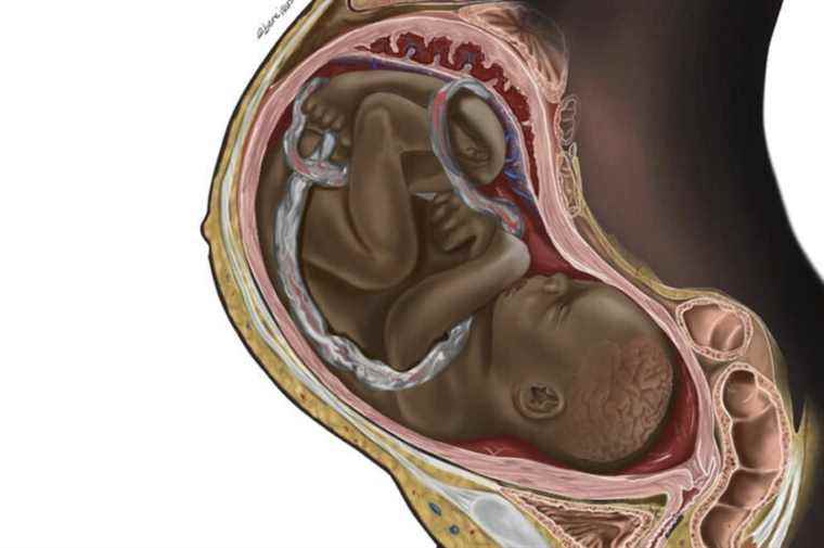 Illustration of a black fetus |  The importance of diversity in medical imaging