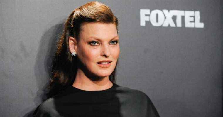 Linda Evangelista disfigured and traumatized: all the handicaps she suffers from