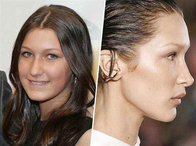 Bella Hadid admits to having had a rhinoplasty at only 14 years old and expresses her regret