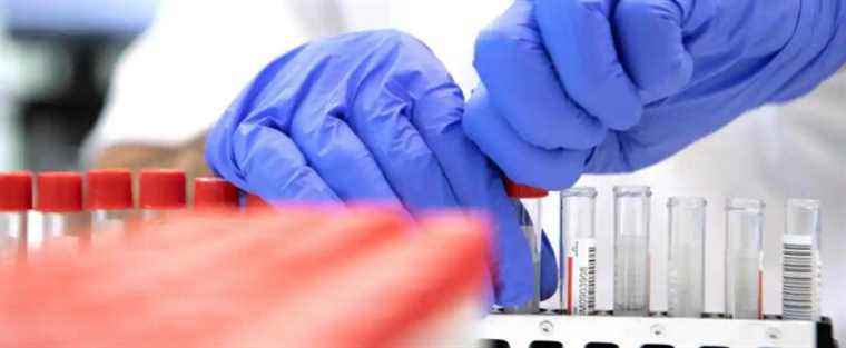 More than 3000 positive cases tested by PCR