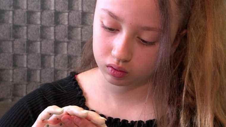 Thanks to her 3D printed hand, a new life begins for little Lou-Ange