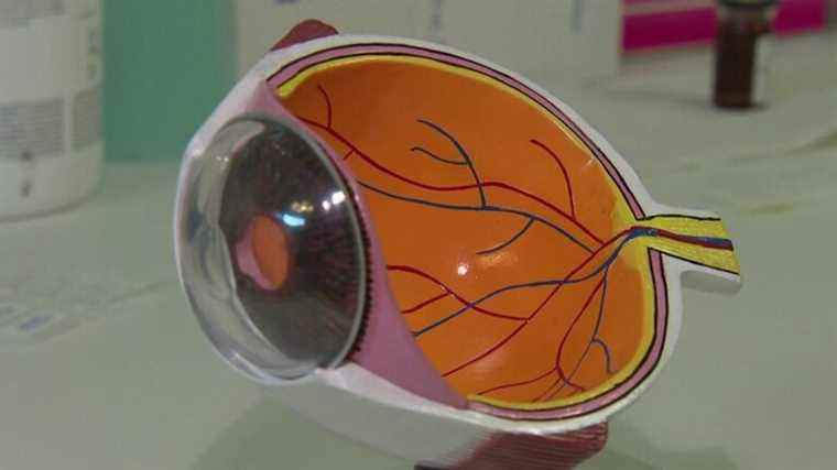 glaucoma, a silent disease that affects many French people