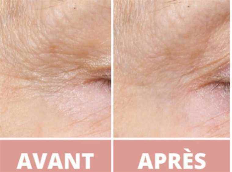 this eye contour treatment smoothes the eyes in less than a month