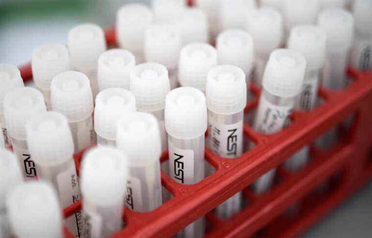 Shortage of collection tubes worsens