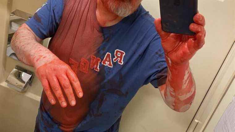 journalist and Nobel Peace Prize winner Dmitry Muratov sprayed with a red product on a train