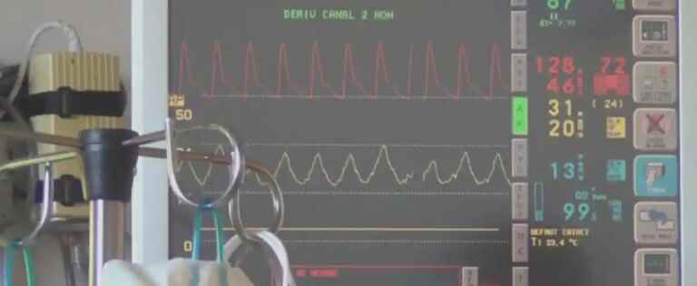 COVID-19: the number of daily hospitalizations reduced to 90 within two weeks