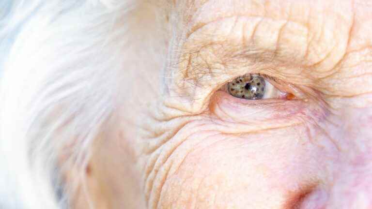 Visual perception disorders and Alzheimer’s disease