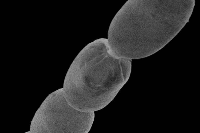 The largest bacteria in the world discovered in Guadeloupe