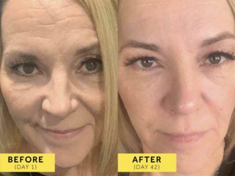 the power of marine collagen on wrinkles will leave you speechless!