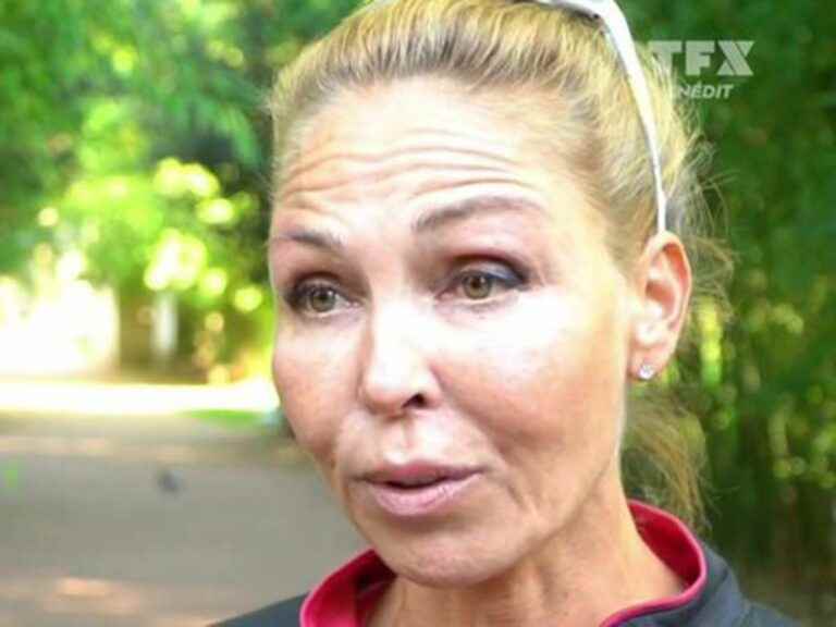 Disfigured because of botox, this famous singer who had disappeared resurfaces…