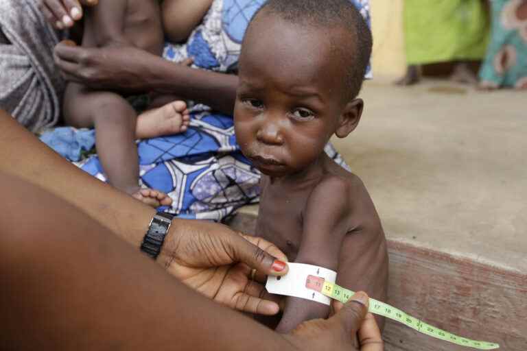 Nigeria hit by growing scourge of malnutrition