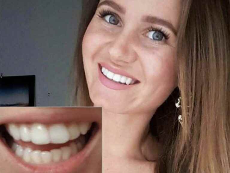 these before/after smiles will leave you speechless!