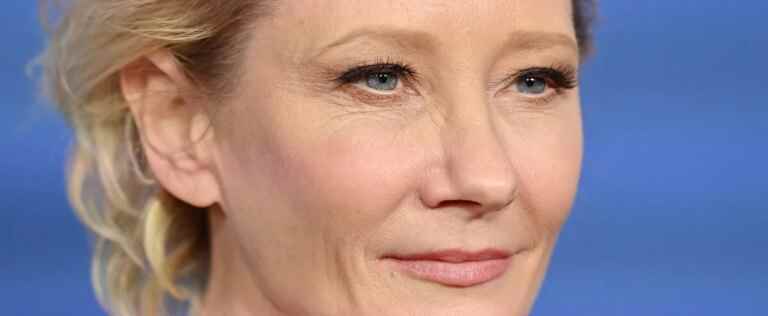 Anne Heche was stuck in her burning vehicle for 45 minutes