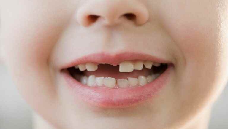 How do we take care of our children’s teeth?