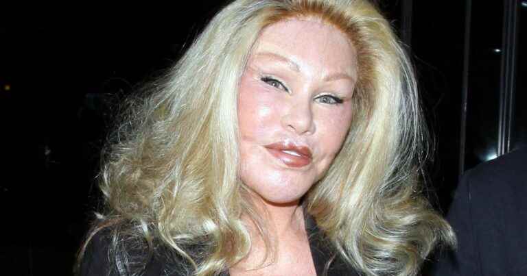 ‘Looks like Madonna’: Unrecognizable catwoman Jocelyn Wildenstein in stunning photo