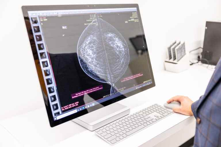 Significant drop in the number of mammograms during the pandemic