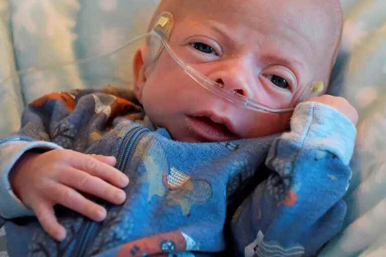 Baby with a degenerative disease |  A plea from parents for screening tests