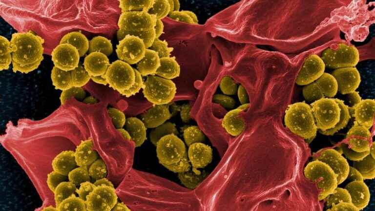 Bacterial infections are the second leading cause of death worldwide, after heart disease