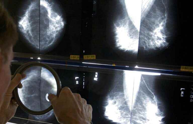 Breast cancer survival rate doubled in 15 years