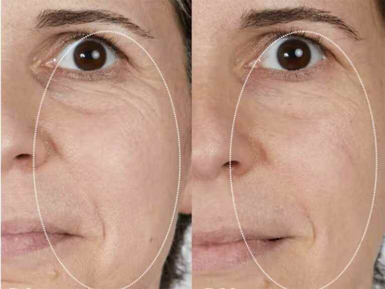 its favorite eye contour treatment reduces 84% ​​of puffiness in just 28 days