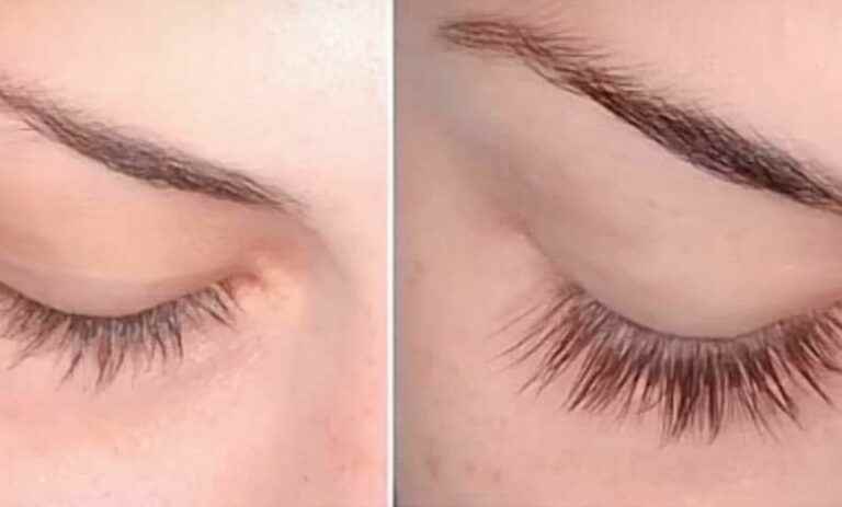 the famous “Multi-Peptides” serum to grow eyelashes is on sale