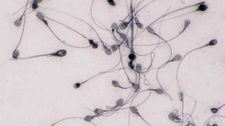 what to remember from the study that supports the hypothesis of a global decline in sperm concentration