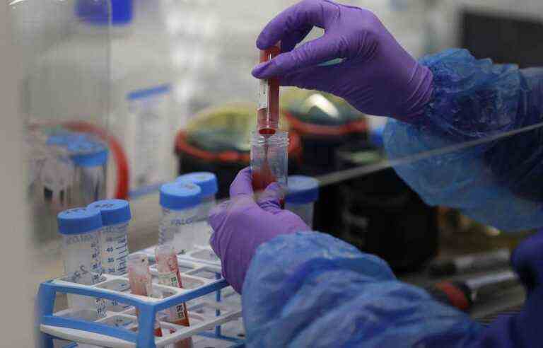 A blood test to diagnose Alzheimer’s