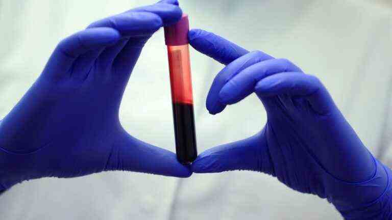 First artificial blood transfusion