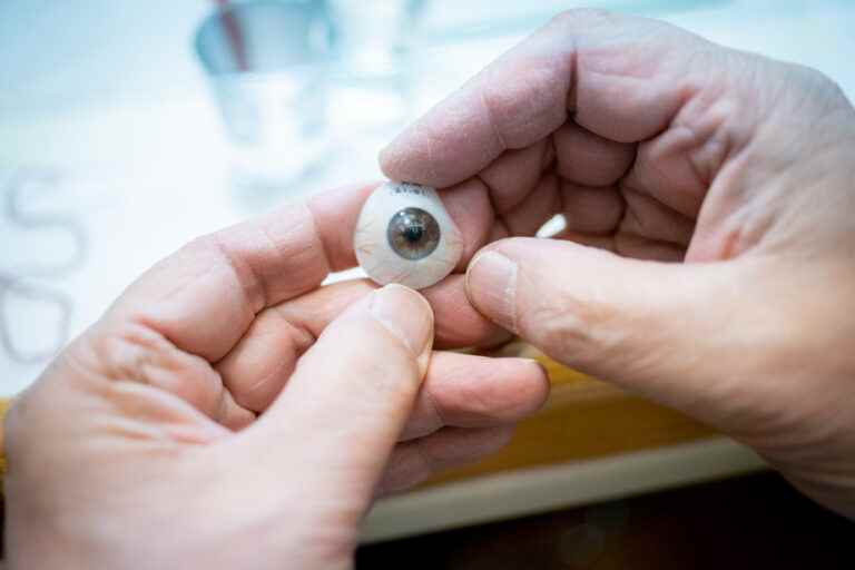 Ocular prosthesis |  The price of an eye