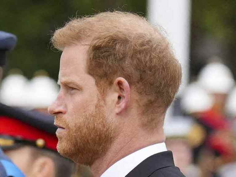 The baldness of prince Harry abusively made up by “People magazine” in One: the Web rises!