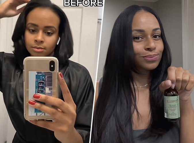 this magic oil that makes hair grow like never before ignites TikTok… and it’s available in France!