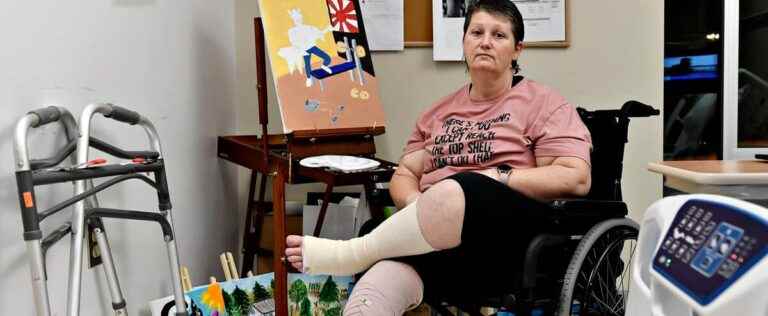 ‘I want to get out of it’: This truck driver has to rebuild her life after losing her leg in a collision