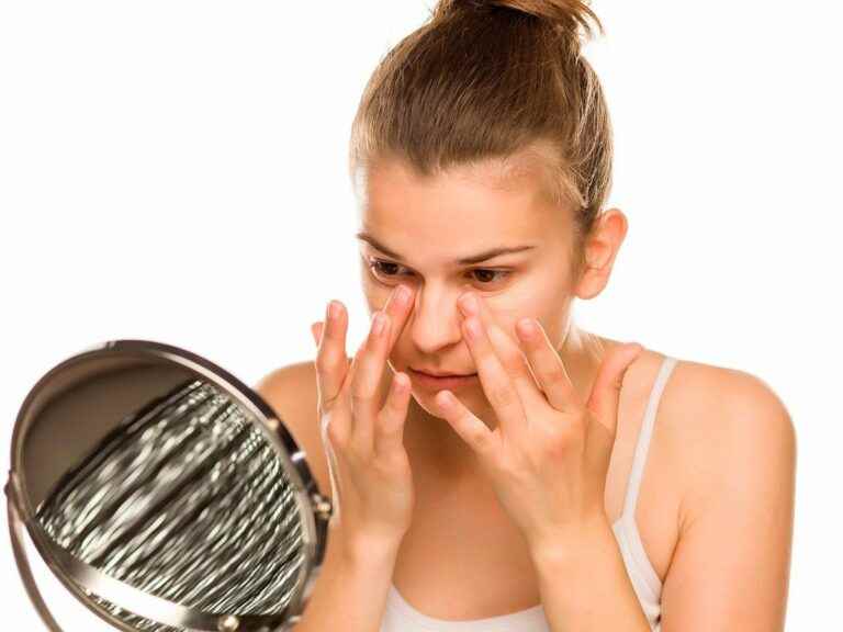 Why do we have dark circles?  Causes, preventions, effective remedies… We tell you everything!