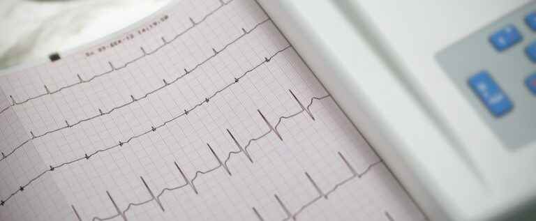 Women more likely to have heart problems than men