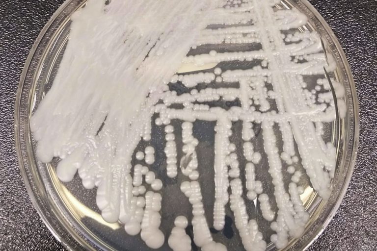 Candida auris |  Canada is not immune to a deadly fungus