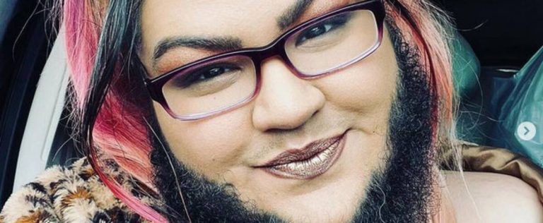 “I am beautiful”: she proudly wears her full beard