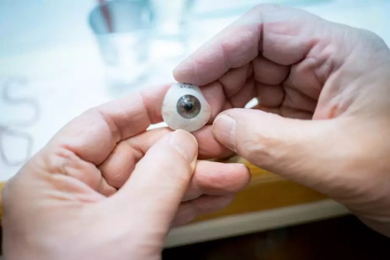 Ocular prostheses |  Quebec will pay more of the bill