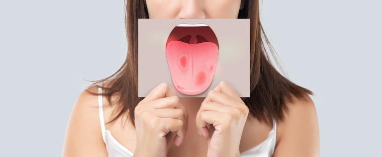 Observing your tongue can reveal a lot about your health