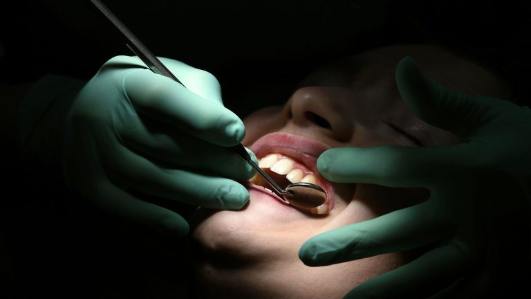 Social Security wants to lower its reimbursements for dental care from October 2023