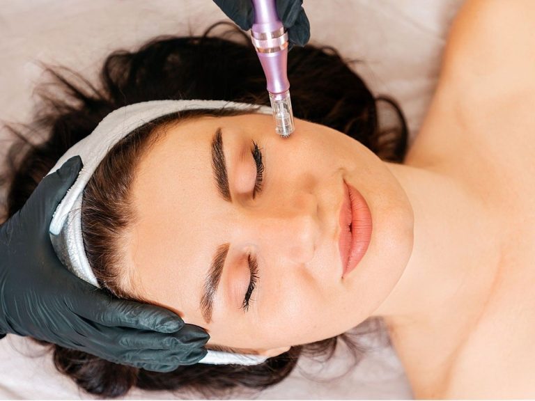 the microneedling method to reduce the signs of aging!