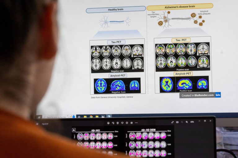 FDA expands access to new Alzheimer’s treatment