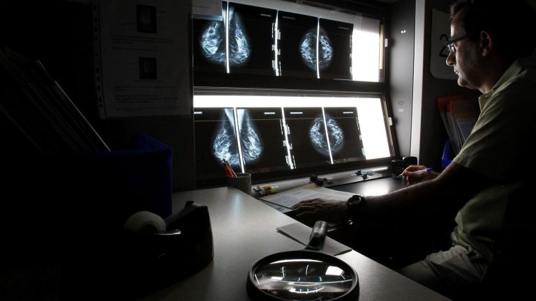 less than one in two women aged 50 to 74 have had their mammogram in 2022, according to a study by the League Against Cancer