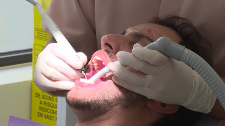 the drop in coverage of dental costs worries patients